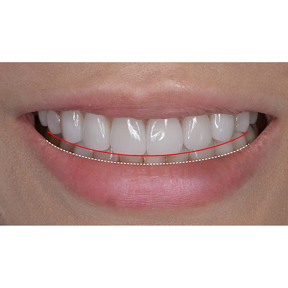 New Silicone Smile Upper and Lower Cosmetic Teeth Tooth Cover Perfect Smile V…