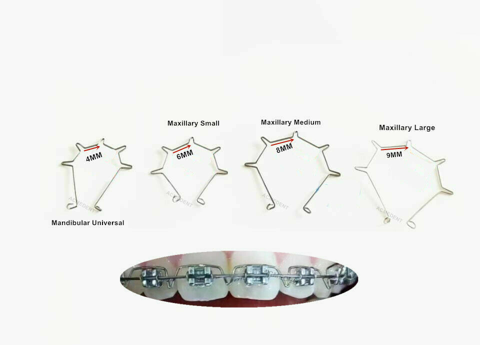 20Pack Dental ART Root Torque Springs Spring 5 Loops Curved Anterior Upper Lower