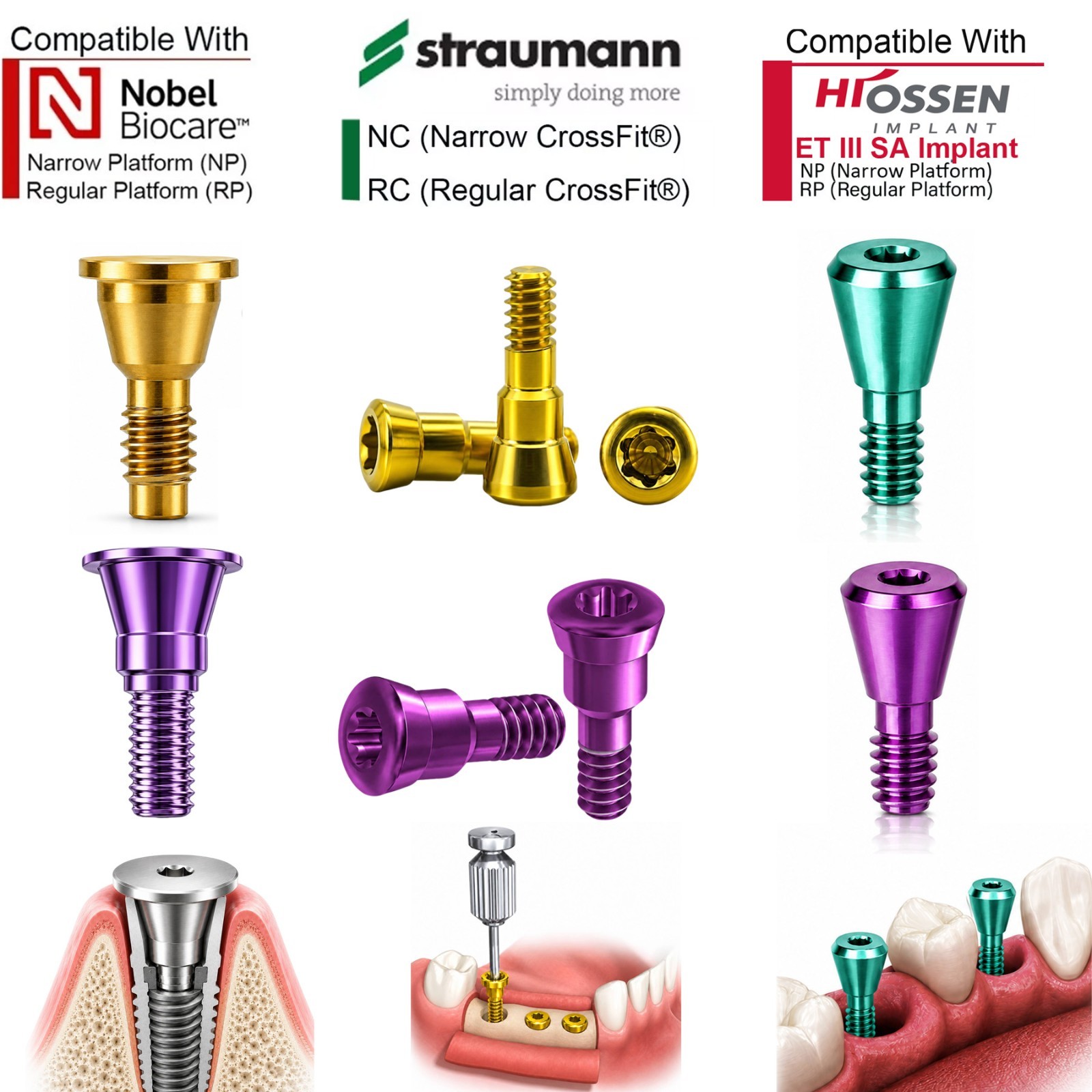 Multiple Implant Healing Abutment & Closure Cover Screw Hiossen Nobel Straumann