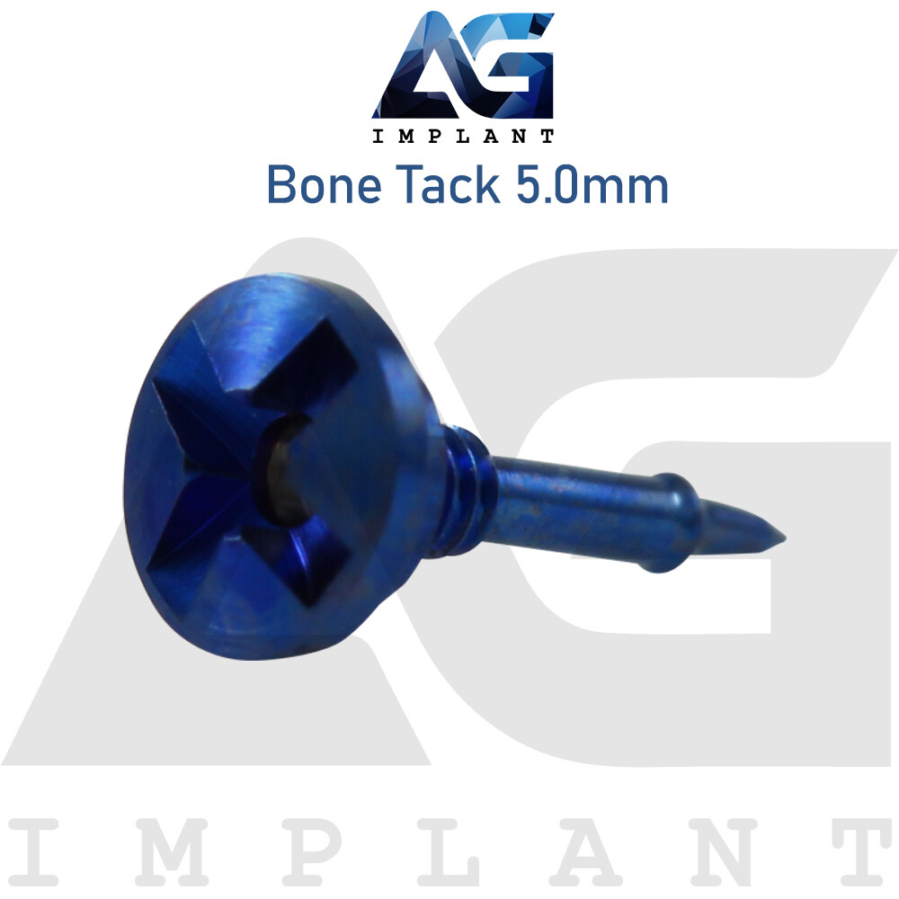 10 Titanium Tack Screw Guided Regeneration GBR Dental Membrane Fix System
